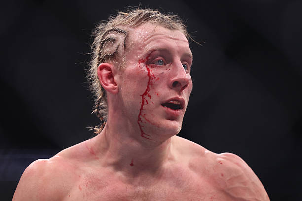 Paddy Pimblett